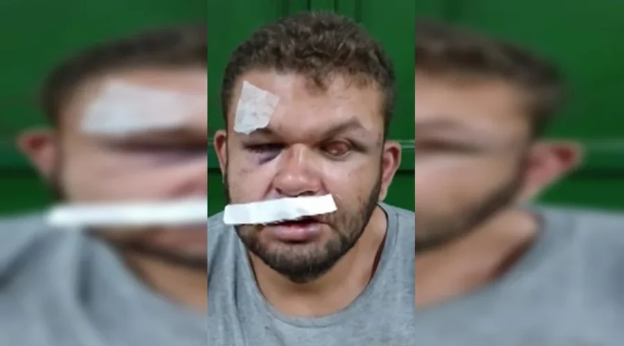Irmãos denunciam agressão em restaurante comunitário de Arniqueira